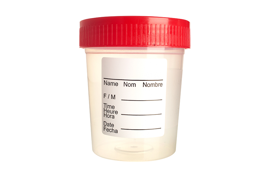 home insemination specimen cup