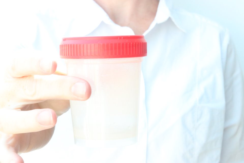 Liquefied sperm in specimen cup