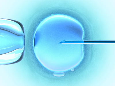 ICSI artificial insemination procedure