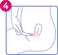 Diagram to show step 4 of inserting a soft cup