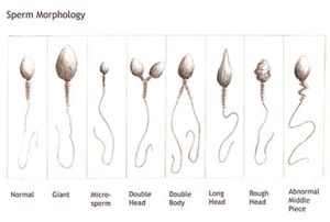 Diagram of sperm morphology